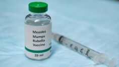 rubella