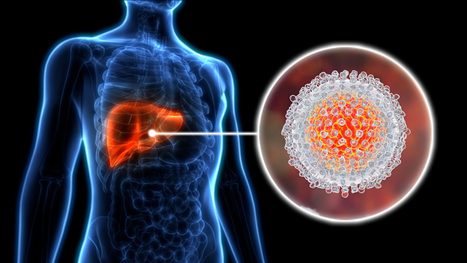 FG STEPS UP HEPATITIS CONTROL TO CURB LIVER CANCER