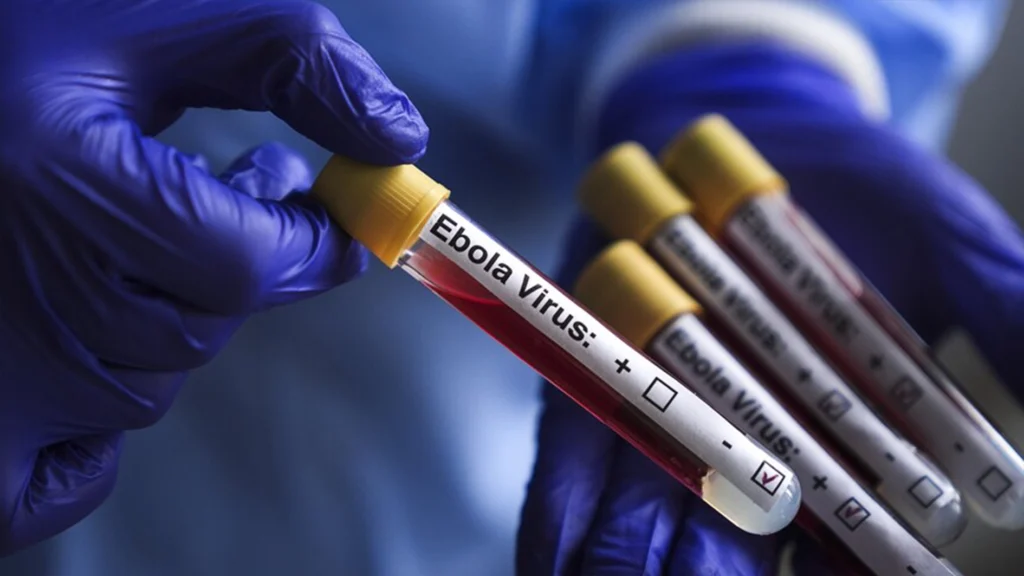 Fresh Ebola Case Triggers Alarm as Emergency Surveillance Measures Intensify