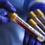 Fresh Ebola Case Triggers Alarm as Emergency Surveillance Measures Intensify